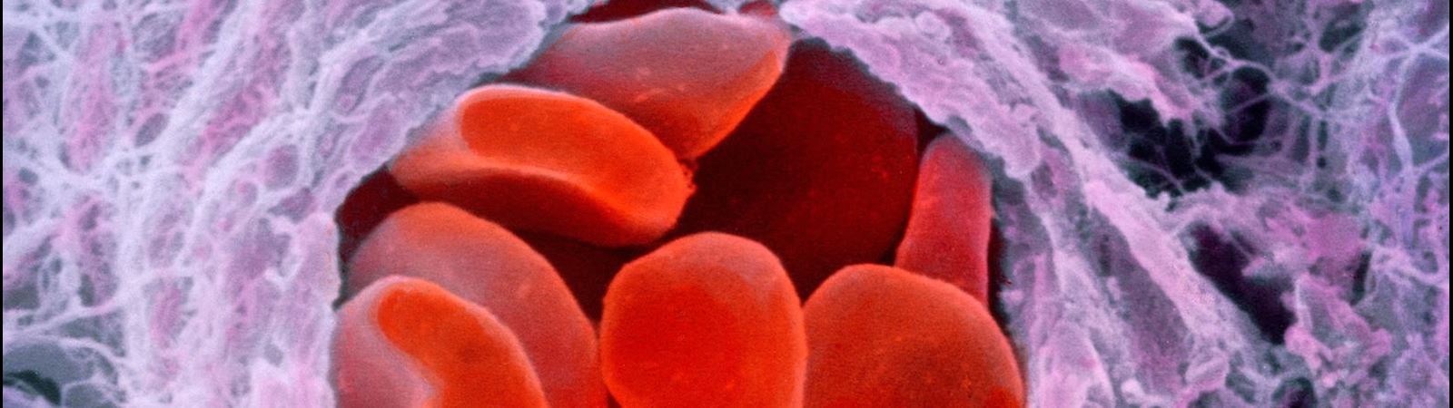 CSL Behring Hematology Congress Website